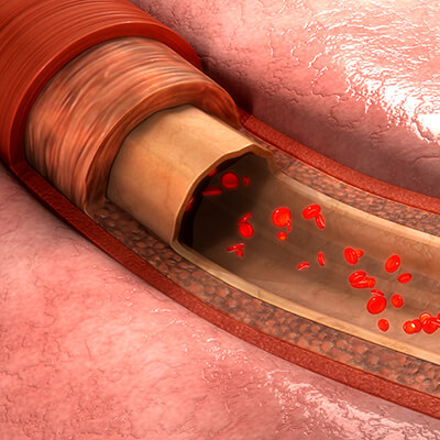 Durchblutung Herz-Kreislauf-System